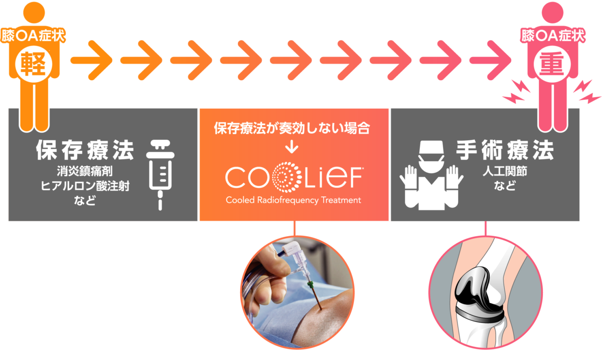 Coolief 治療の選択