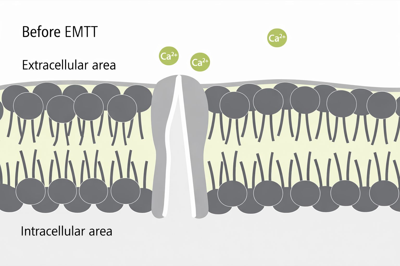 EMTT治療前：イオンは外にとどまっています