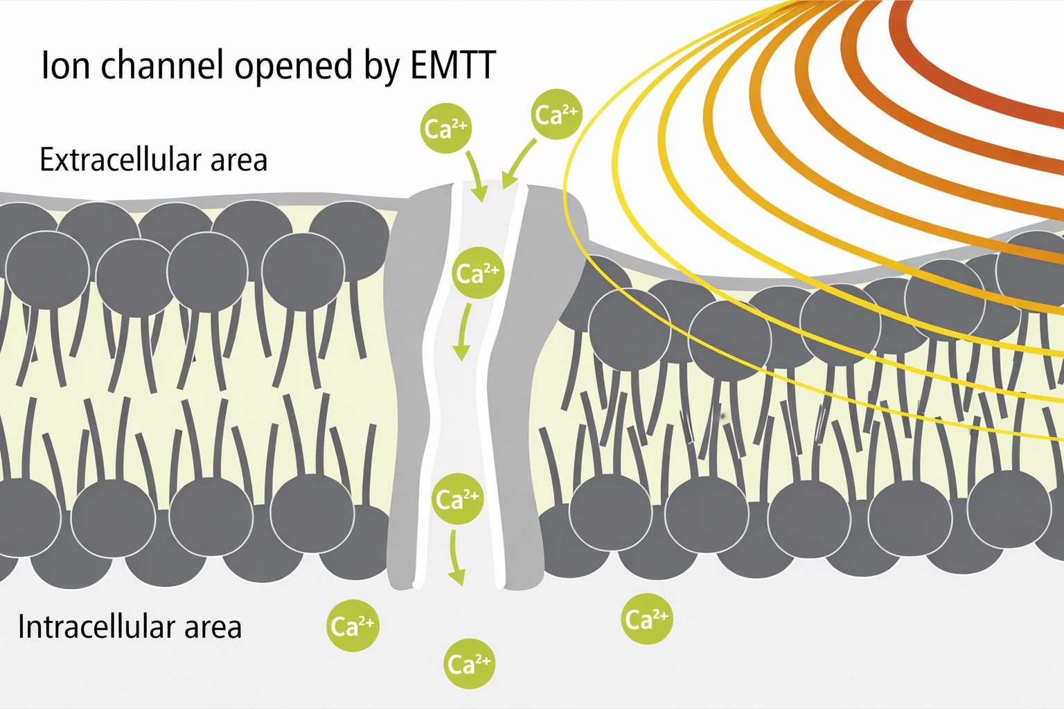 EMTT治療（オレンジ線）で：イオンが細胞内に移動します